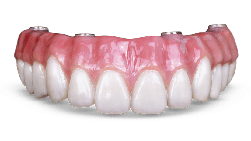 entenda como funciona o protocolo all on 4, a Humaniza Odontologia é especialista neste tratamento.