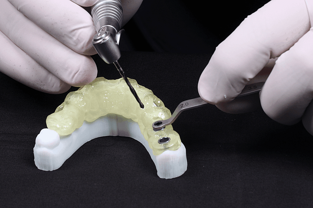 Humaniza Odontologia - Invisalign: os benefícios do tratamento